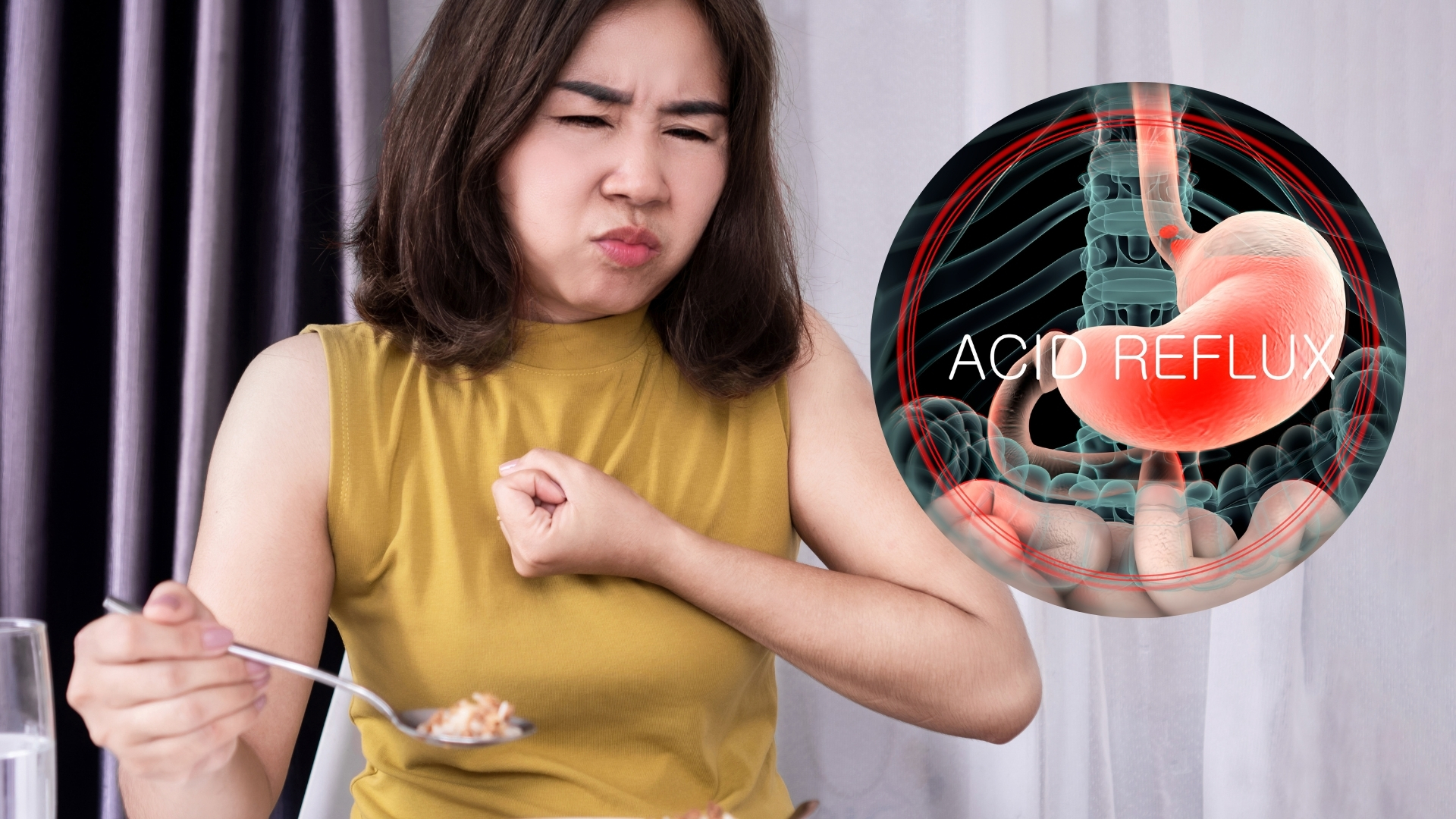Acid dạ dày trào ngược lên thực quản kích thích cổ họng và gây ho
